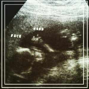 16 week ultrasound