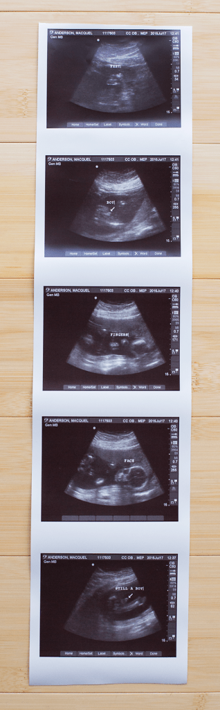 ultrasoundphotoscrop