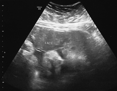 35 Week Ultrasound - Beautiful Things Await You