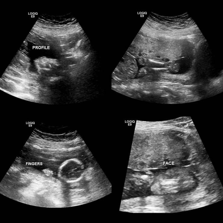 22338833_10155789933737938_5535084484004262192_o